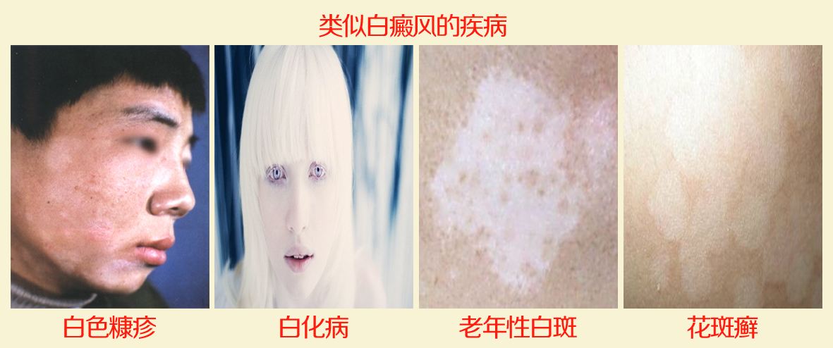 综ʳҪעЩʲô
